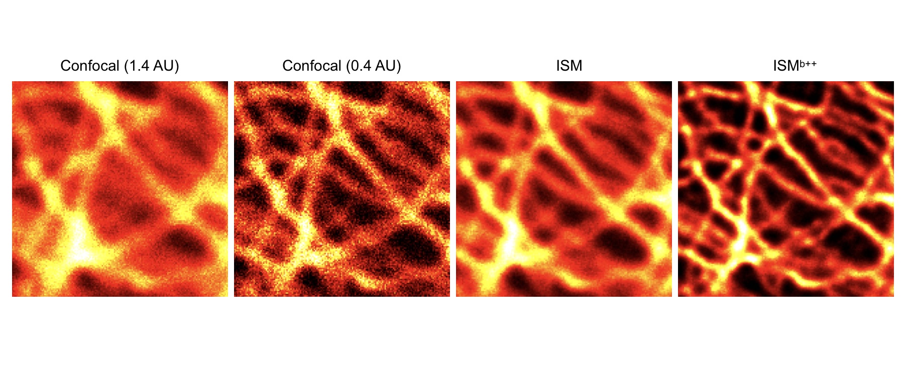 Confocal Versus Image Scanning Microscopy